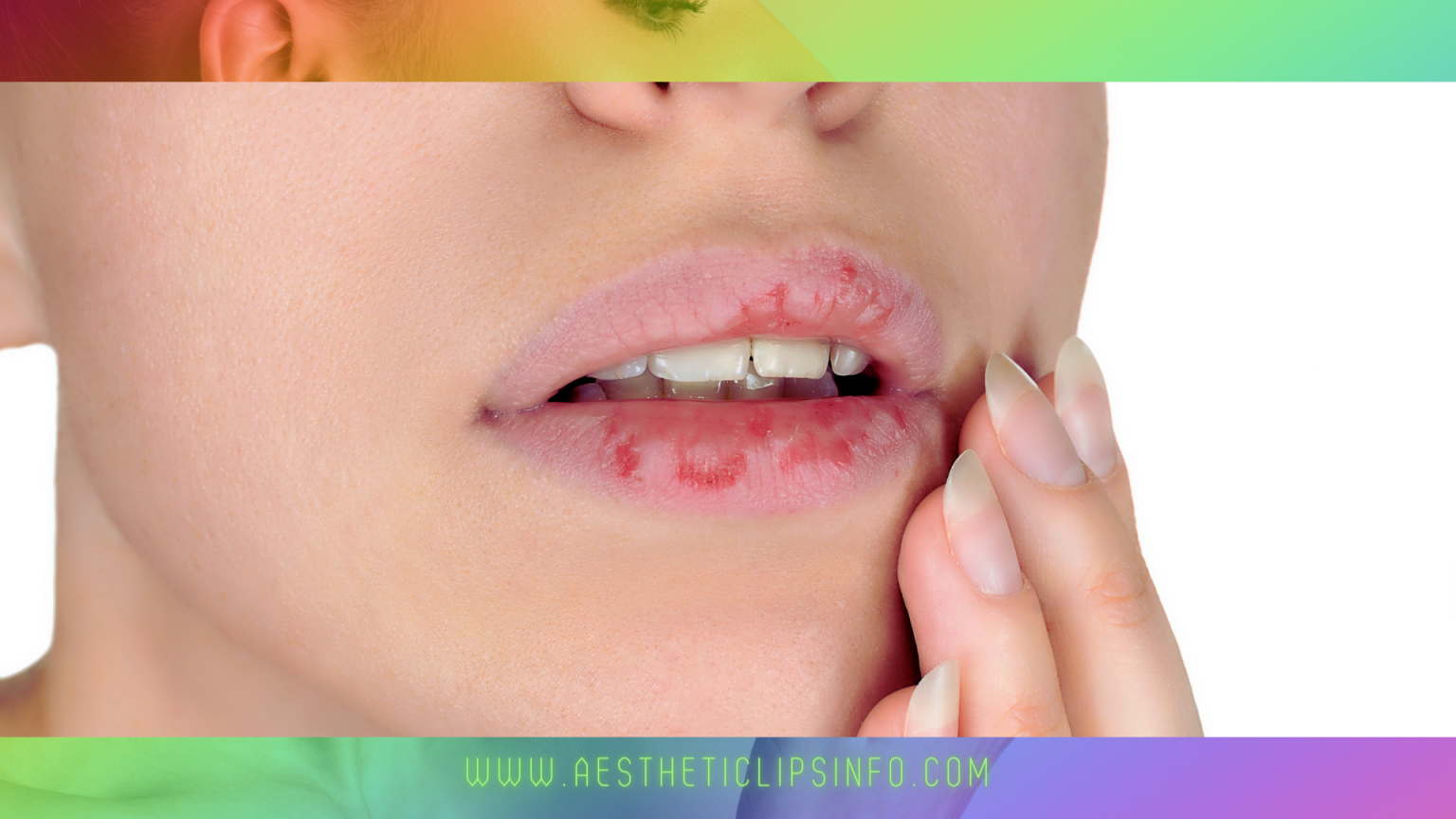 Home Remedies For Busted Lips 2024 AestheticLipsInfo